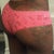 5 weeks post-op