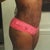 5 weeks post-op