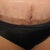 Scar at week 3.  Overall thin, and flat.  No puckering.  No redness.  Looks good.