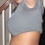 left side view 5days post tt, bruising from liposuction