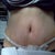 5 days post