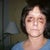 5 days after - just had the stitches removed & nose cast.