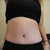 3 weeks post op