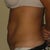 Got my before pictures sent to me by my PS
