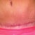 7 weeks PO