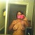 1 and a half weeks post op