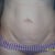 Pre-Op