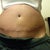 Swollen really bad