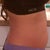 DAY 4 lower abdomen