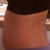 DAY 4 lower abdomen