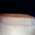 Bandages