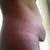 Side view Pre Op