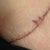 Incision on right side. Seems pretty straight.