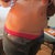2013 - 9 months post scar revision.  1 year 9 months after TT. My scar is fading nicely - keep in mind this is January 1st 2013 - taken after a week of stuffin my face!!