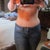 2013 - 1 yr 9 mo post TT & 9 mo post scar revision.  1/1/13 - I know some ladies don't like hips but I LOVE my hourglass shape!!  Keeping my hips was a must!