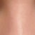 before surgery - view 2