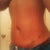 3 weeks post op