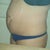 before pic. Hate the way my stomach looks.