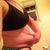 so much loose extra belly skin!