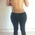 5day post op