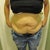 Front view-2.5 months pre-op.Here's the damage.I have managed to loose 80lbs since my daughters birth and keep off 60lbs of it.Now I'm working on the other 20lbs