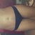 2 wks po