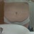 Pre-op - the chunk that has GONE!