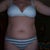 stomach before