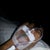 My IV before surgery