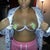 One Day Post Op, no bruising s of yet, feeling pretty good, It's a bit swollen but I think I will be like a full B or small C cup, my surgeon gave me the size I exactly wanted, feeling truely blessed!