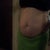 3 months pre-op, before weight loss. Weight 174