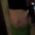 3 months pre-op, before weight loss. Weight 174