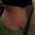 3 months pre-op, before weight loss. Weight 174