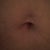 3 months pre-op, before weight loss. Weight 174