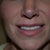 3 months notice my teeth were fixed too!