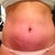 6.5 weeks after