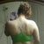 Six and a half weeks post op