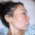 Me before surgery to open the abscess