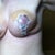 Left boob almost full and normal looking. The side needs to fill in eventually