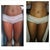 B4 pic & 1 month post op