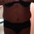 3 weeks post-op