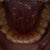 My bottom teeth, after Invisalign but before six months of braces.