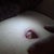 3/17 Belly Button.  Popped an internal stitch and scar is separating.  Super gross!