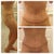 12 Days PO. Swollen in the upper abs.