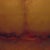 2 Weeks and wound thats opened up due to an infection (sorry for the graphic pic)