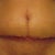 2 Weeks Front View