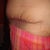 3 weeks side view