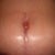 5 Weeks belly button View