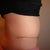 3 months - The fat above my bb is that nasty visceral fat that only losing weight and exercise will get rid of.....I WILL do it!