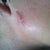 scar from whatever they messed up still don't know how this happened